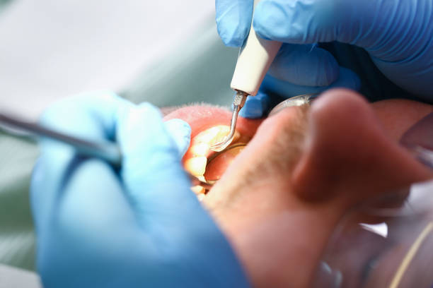 Best Emergency Dental Surgery in West Lealman, FL